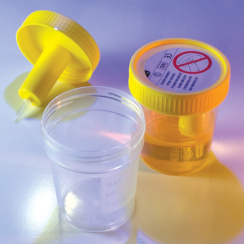 Globe Scientific TransferTop Urine Collection Cup with Integrated Transfer Device, 4oz (120mL), Graduated to 100mL, STERILE, Bulk Transfer cup; urine Transfer; 120mL Container; Container